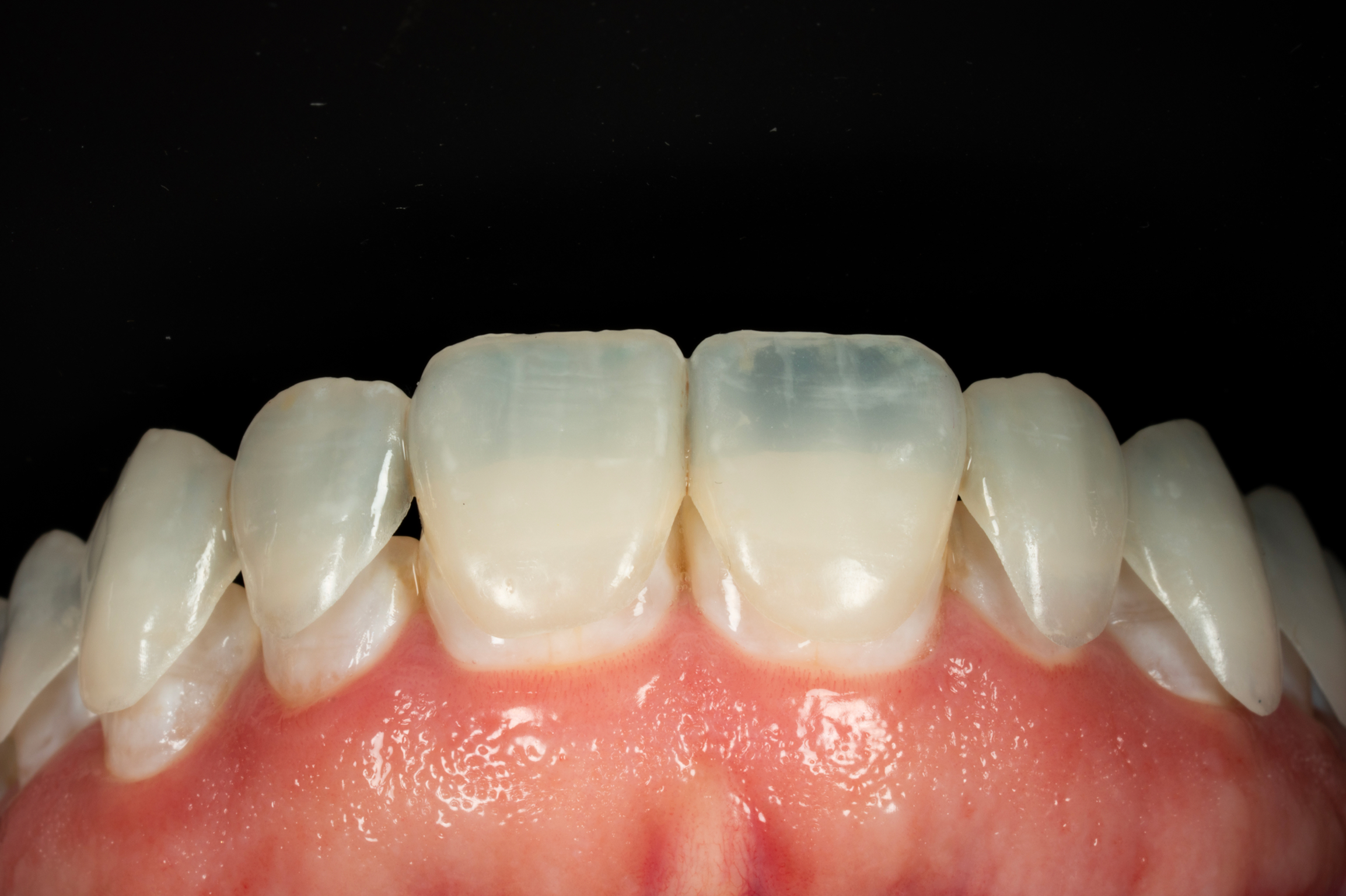 Dentist showing a patient something on a tablet